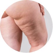 Body+