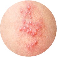 Antiviral