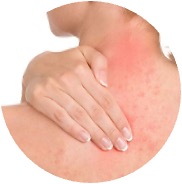Anti-inflamatório